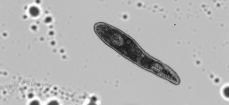 Monochromatic light micrograph of an unidentified flatworm, a member of the meiofauna, collected from the bottom three centimeters of a multi-year ice floe.