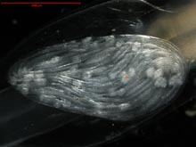 Close-up of a Eukrohnia hamata egg sac