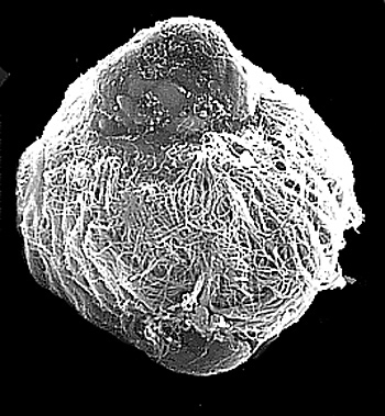 NOAA Ocean Explorer:Gulf of Mexico: Ciliated larva of a tubeworm.