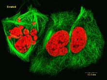 treated human lung cancer cells