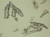 Microscopic spicules