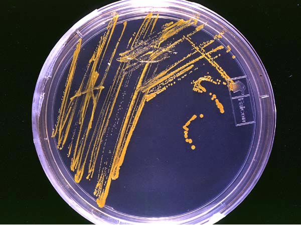 Agar plate with microorganisms isolated from a deep-water sponge.