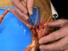 Spider crabs, Macroregonia macrochira, were collected from a depth of 2900 meters on Pratt Seamount.