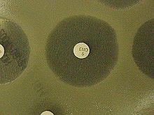 results of a Kirby-Bauer disk diffusion antibiotic susceptibility test