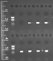 Agarose gel electrophoresis of PCR product