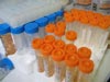 Test tubes containing samples of Chrysogorgia for DNA analysis.