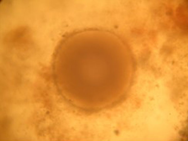 Egg from Acanella sp.