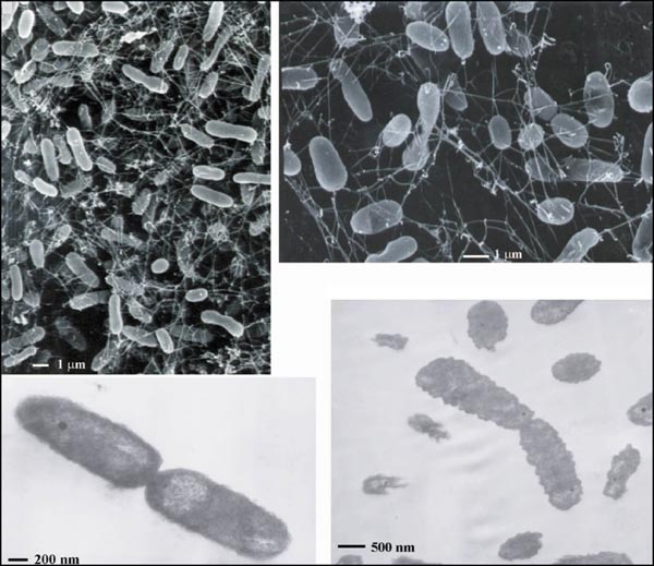 Electron micrographs of bacterial isolate from Axial Seamount, Juan de Fuca Ridge.