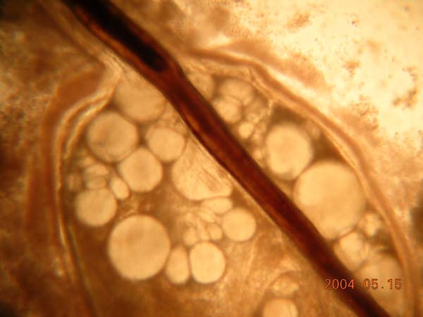 View of live <em>Metallogorgia melanotrichos </em> polyp with gonads