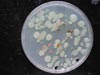 Each spot on this agar plate is a bacterial colony recovered from a marine sponge sample.
