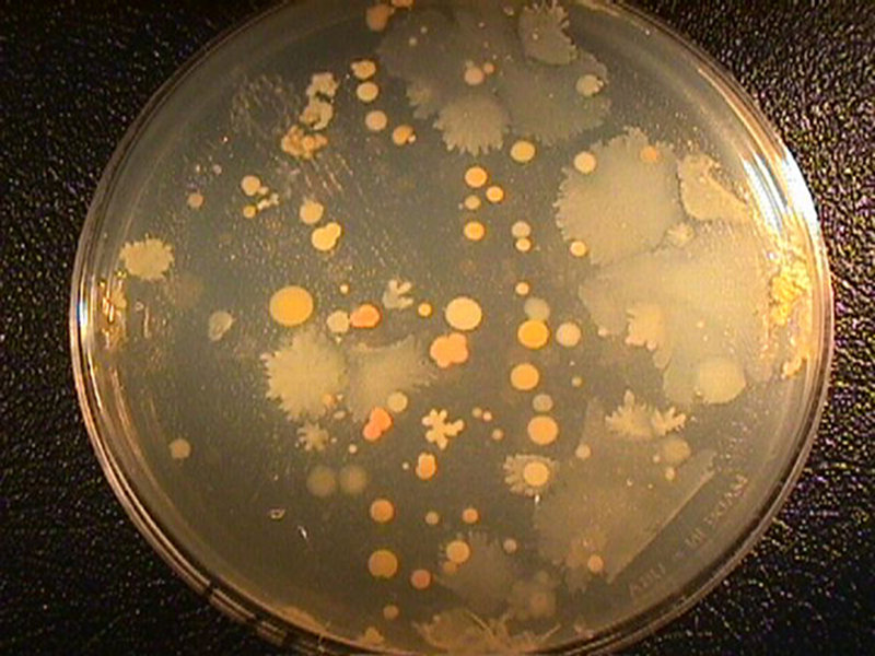 Marine bacteria growing on an agar plate.