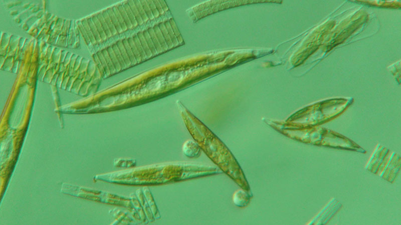 A microscopic view of ice algae from the Arctic.