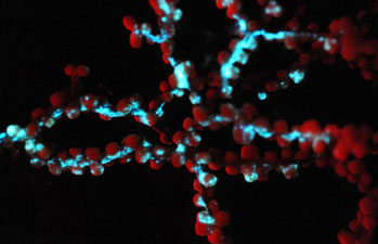 Bioluminescence 2009: Living Light on the Deep-sea Floor