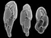 Foraminifera.