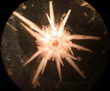 microscopic urchin