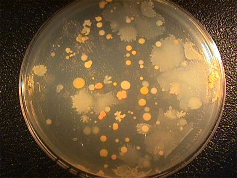 Marine bacteria growing on an agar plate. Image courtesy of Lophelia II 2012 Expedition, NOAA-OER/BOEM.