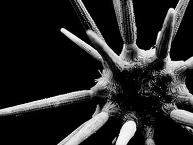 Urchins are just one of the many animals found in association with deepwater coral.